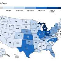 New CDC Map Shows Massive Cyclospora Surge Across 48 States