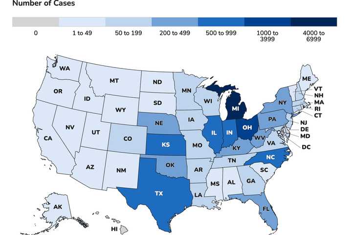 CDC Map Shows Massive Cyclospora Surge Across 48 States, DC