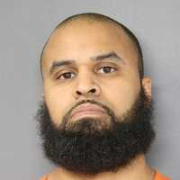 Massage Therapist Sexually Assaults Customer At Bergen County Spa: Prosecutor