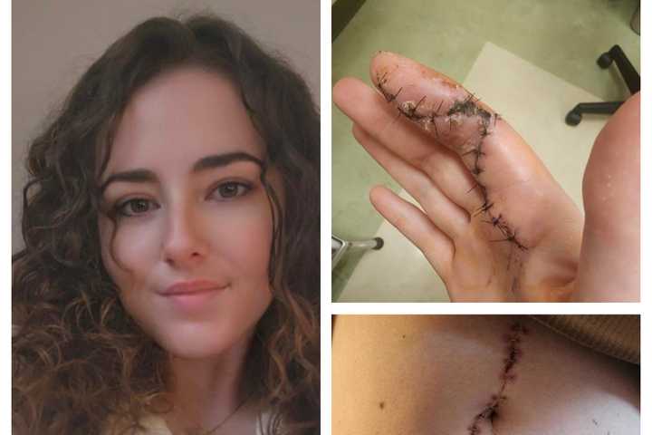 Pembroke Woman Who Survived Being Stabbed 11 Times Now Faces Homelessness