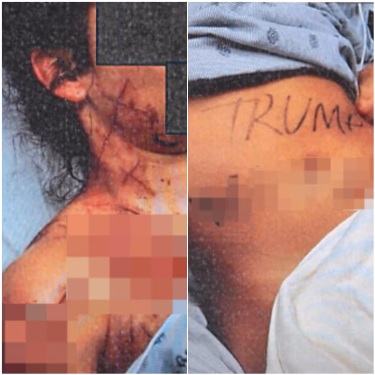 Natalie Greene hired an artist to sculpt cuts into her body and had the words "Trump Whore" written on her stomach when officers found her zip tied in the woods, officials said.