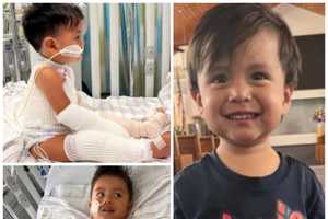 Toddler Airlifted With Severe Burns After Falling In Campfire Reportedly In Belleplain Forest