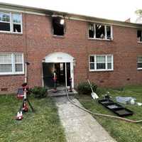 Man Dead, Woman, Three Children Injured In Maryland Fire