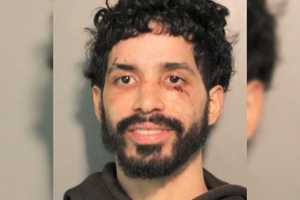 Man Bites Officers During Roosevelt Field Mall Fight: Nassau County Police