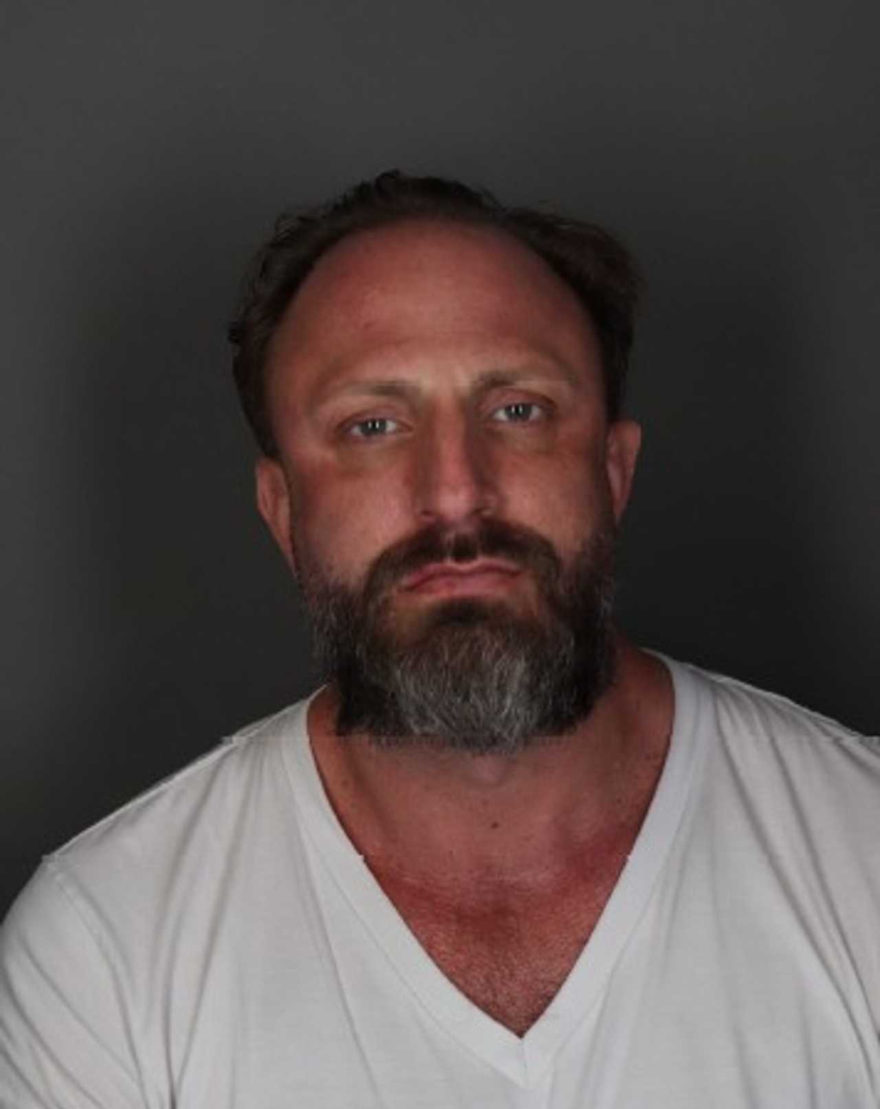 Man Accused Of Punching Girlfriend Several Times In Rye, Sending Her To ...