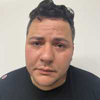 Driver Hits 77-Year-Old Woman, Leaves Her On Bergen County Road For Dead: Officials