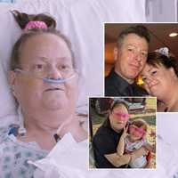 <p>Lisa Pisano, the second-ever recipient of a heart pump and pig kidney combo, has died.</p>