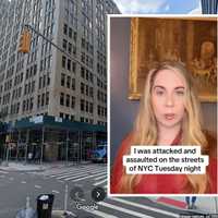 'Vendetta Against Women:' NJ Reporter Details Random, Bloody Attack On NYC Streets