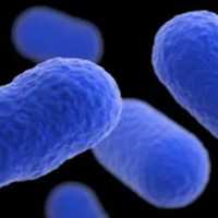 Infant Dies, 10 Others Sickened In Listeria Outbreak Involving Meat, Poultry Products