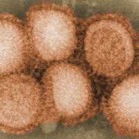 Rare Bird Flu Case Confirmed In Child, CDC Says