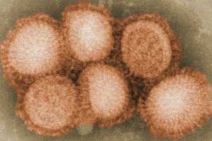 First Severe Bird Flu Case Confirmed In US