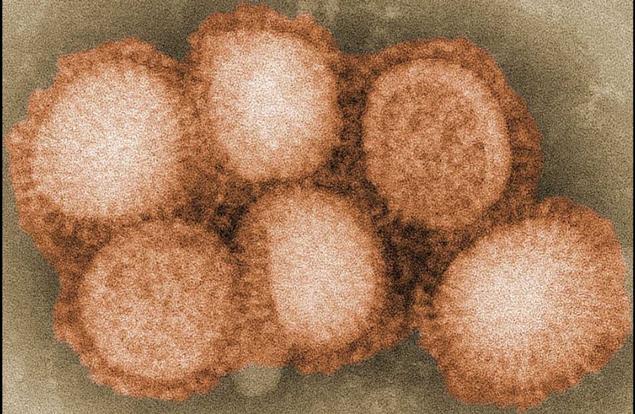 Rare Bird Flu Case Confirmed In Child, CDC Says Peabody Daily Voice