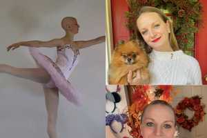 Ellicott City’s Maggie Kudirka, ‘Bald Ballerina,’ Dies at 33