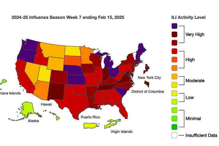 These States Seeing Highest Rates As Flu Hospitalizations Spike Amid Worst Season In Years