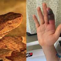 NY Cyclist Bitten By Venomous Snake On Bike Path After Getting Too Close