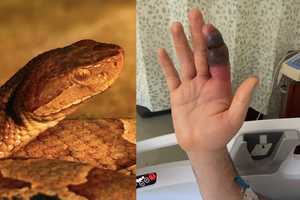 Cyclist Bitten By Venomous Snake On NJ Bike Path After Getting Too Close