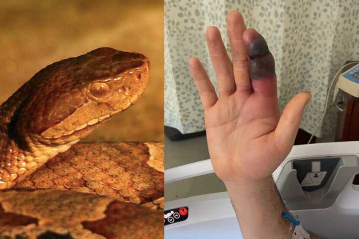 Cyclist Bitten By Venomous Snake On NJ Bike Path After Getting Too Close