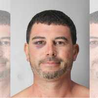 Long Island Man Assaults PSEG Worker, Then Kicks Hospital Wall, Cops Say