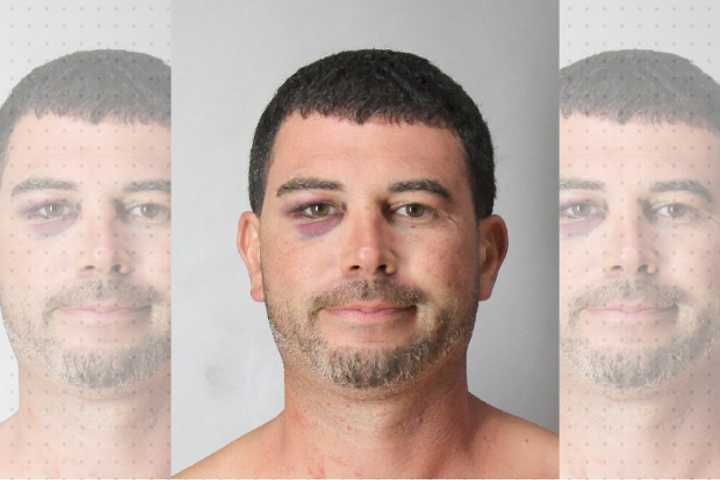 Lynbrook Man Assaulted PSEG Worker, Then Kicked Hospital Wall, Cops Say