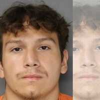 'Slash Marks All Over': Teen Attacked During Fight At Bergen County Home