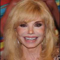 Loni Anderson, Iconic 1980s Sitcom Star, Dies