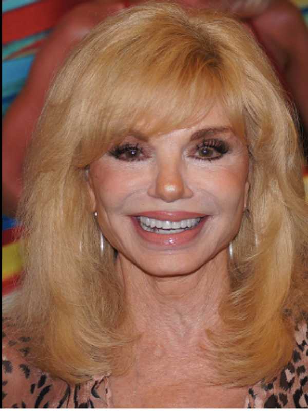 Loni Anderson, Iconic 1980s Sitcom Star, Dies