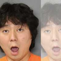 'We Were Just F—ing,' Assault Suspect Tells NJ Cops After Leaving Woman With Collapsed Lung: PD