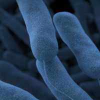 6 Dead In NYC Outbreak Of Legionnaires' Disease