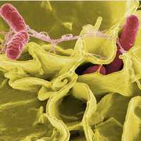 CDC Reportedly Reduces Scope Of Foodborne Illness Tracking