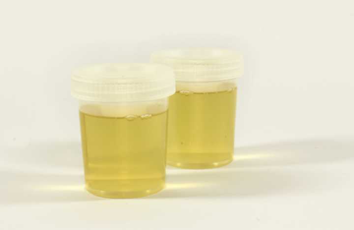 Urine test cups.