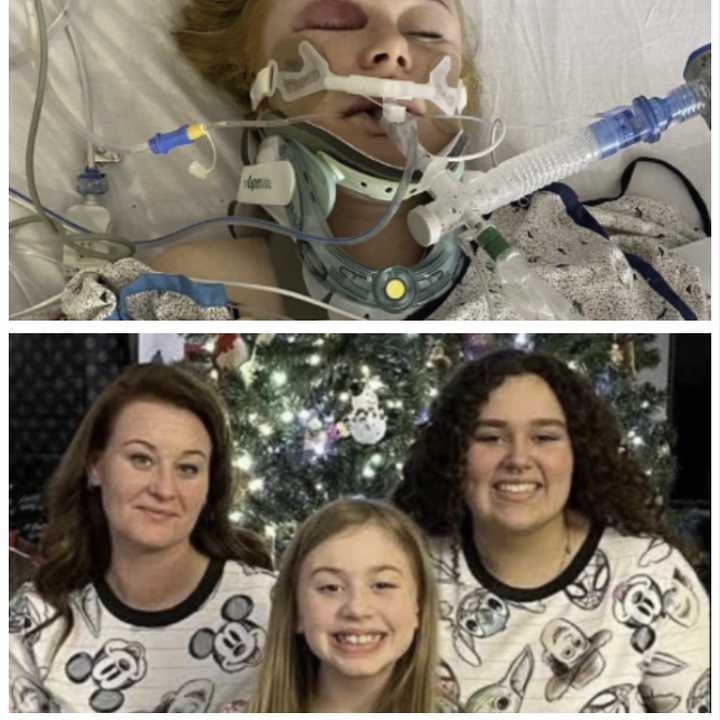 April Hoyrup  and her daughters (bottom) and when she was intubated in the hospital after the hit-and-run strike. 