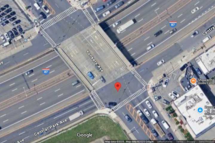 Man Struck By Car In Yonkers, Hospitalized