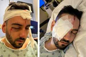 Beaten, Blinded, But Not Broken: Maryland Man Seeks Justice After Brutal Attack