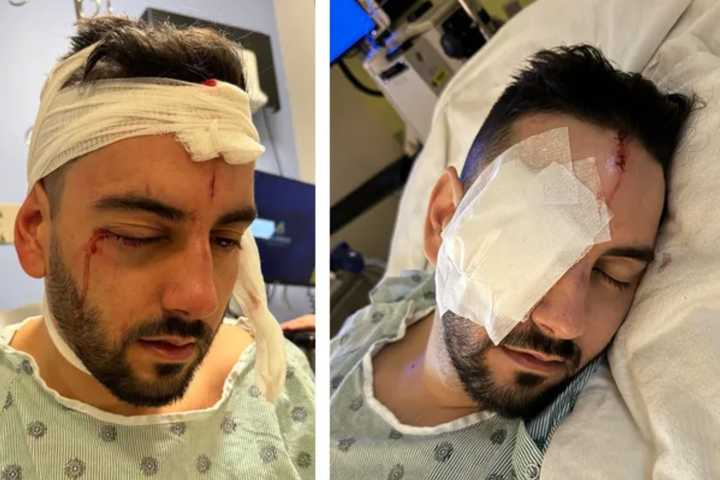 Beaten, Blinded, But Not Broken: Baltimore Man Seeks Justice After Brutal Attack