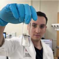 Hidden Dangers: Study Reveals High Levels Of Plastics In People's Brains