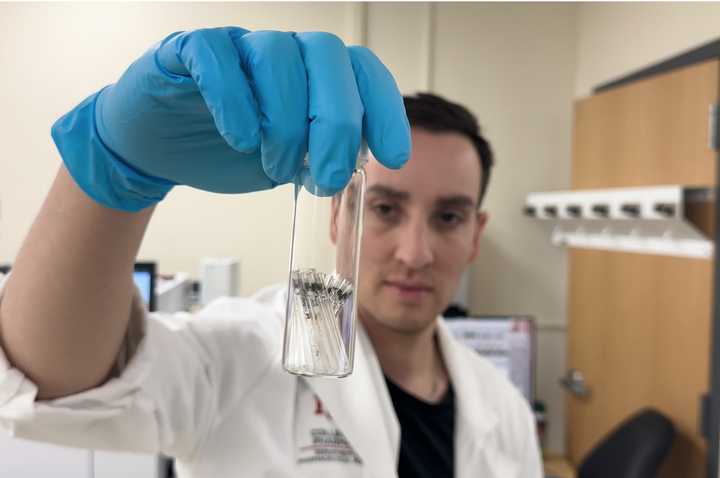 University of New Mexico Health Sciences researchers have found microplastics in human brains, and at much higher concentrations than in other organs, having increased by 50 percent over just the past eight years.