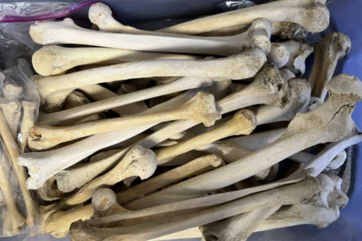 Stillborns, Harvard Cadaver Parts Trafficked To PA: DOJ Secures Guilty Plea