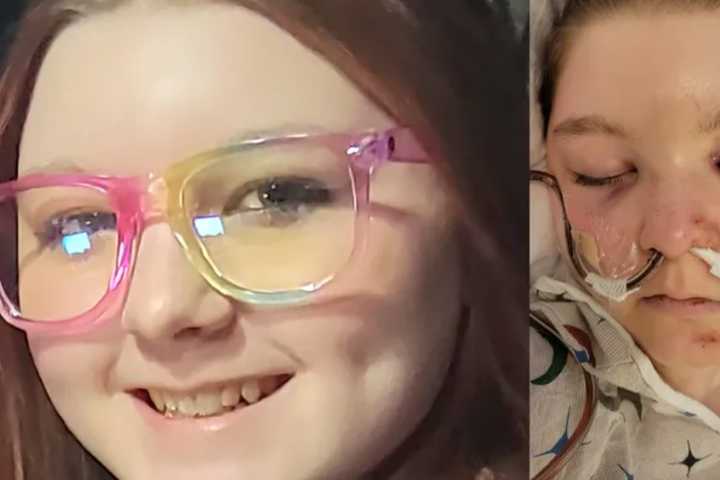 ‘I Saved Us’: Maryland Girl, 13, Calls 911 After Crash, Fights Through Pain To Come Home