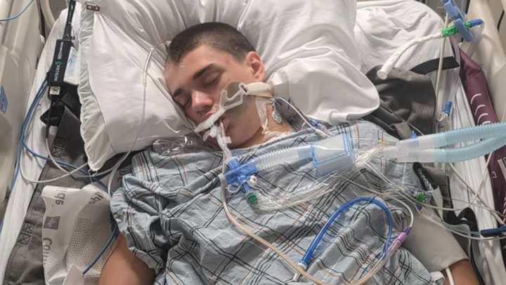 Colton Sonner, age 18, was critically injured in a crash in Pleasant Valley days before his high school graduation. 