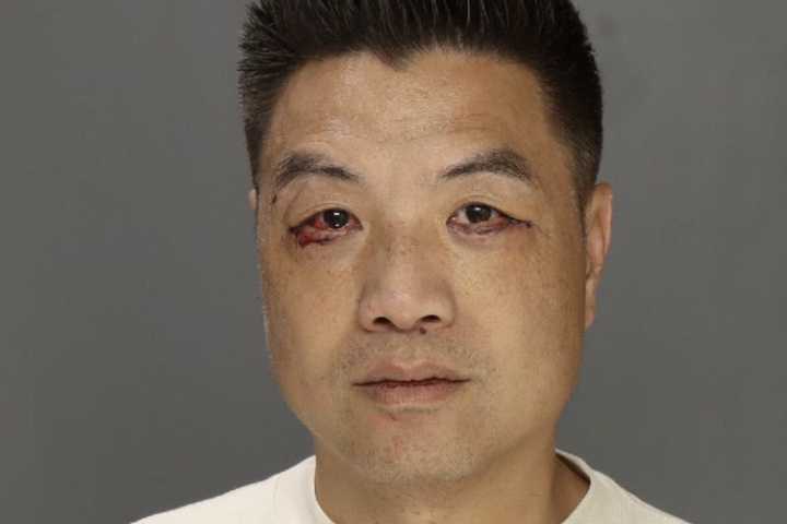 PA Man Slaps, Punches, Bites Family, Then Charges At Them With Knife: Police
