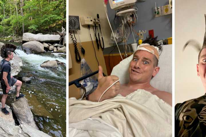 Baltimore Bartender, Drummer Injured In ‘Freak, Metal AF’ Accident: ‘The Mohawk Will Grow Back’