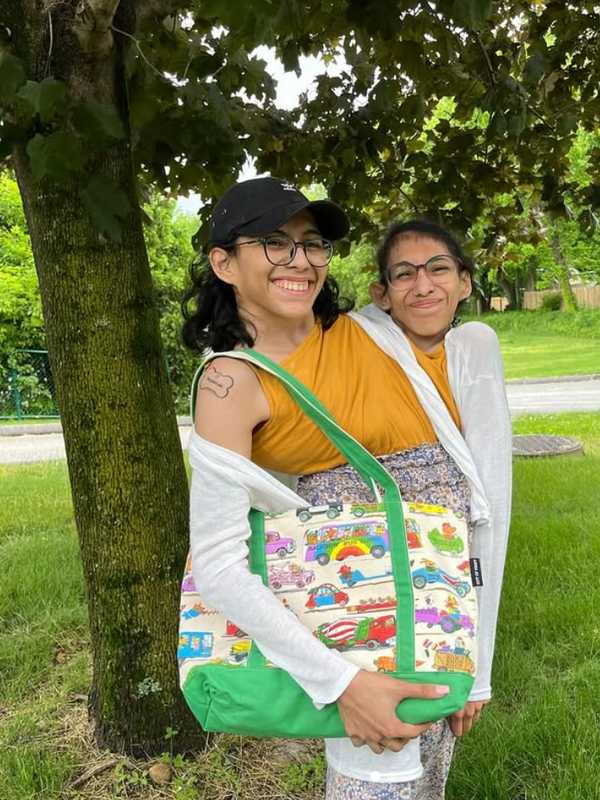 Conjoined Twin Marries, But Internet Won’t Stop Asking About Their Bedroom Habits