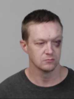 Bruised Mugshot Marks 3rd Suspect In Three Days To Attack Spotsylvania Deputies: Sheriff