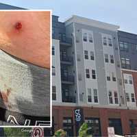 'Could Have Been Our Kids': BB Gun Fired From LI Apartment Strikes Man Outside Restaurant