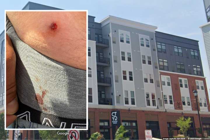'Could Have Been Our Kids': BB Gun Fired From Ronkonkoma Apartment Hits Man Outside Restaurant