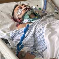 Expectant Dad ‘Fighting For His Life’ After Devastating Motorcycle Crash In Hudson Valley