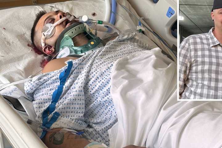 Expectant Dad ‘Fighting For His Life’ After Devastating Motorcycle Crash In Liberty