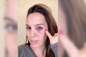 Disney's Christy Carlson Romano Shot In Face At Clay Pigeon Range: 'Be Grateful For Every Day'