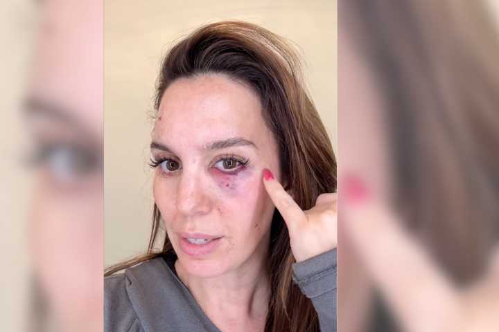 CT Native Christy Carlson Romano Shot In Face At Clay Pigeon Range: 'Be Grateful For Every Day'