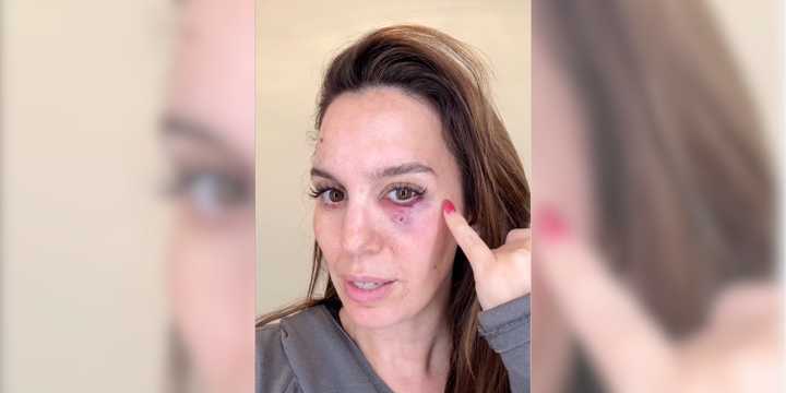 Disney's Christy Carlson Romano Shot In Face At Clay Pigeon Range: 'Be